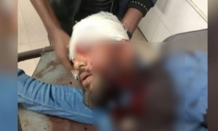 এবার খুলনায় গুলিবিদ্ধ এনসিপি নেতা, অবস্থা আশঙ্কাজনক