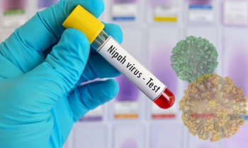 দেশে নিপাহ ভাইরাসে একজনের মৃত্যু, সতর্কবার্তা হু’র