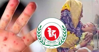 দেশে গত ২৪ ঘণ্টায় হাম ও হামের উপসর্গ নিয়ে আরও ১১ শিশুর মৃত্যু দেশে গত ২৪ ঘণ্টায় হাম ও হামের উপসর্গ নিয়ে আরও ১১ শিশুর মৃত্যু