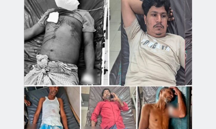 এবার রাউজানে বিএনপির ৫ নেতাকর্মী গুলিবিদ্ধ